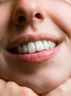 O que não fazer após o clareamento dental?