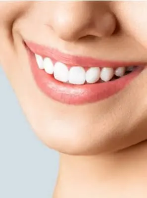 Clareamento dental caseiro: bicarbonato de sódio funciona?