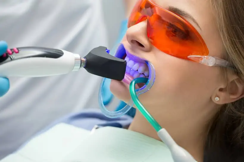 Todo dentista é qualificado para realizar o clareamento dental caseiro ou em consultório