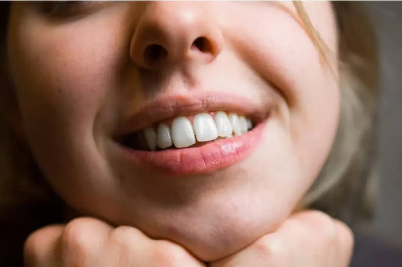 Os cuidados após clareamento dental a laser ou caseiro são de extrema importância para os resultados do procedimento