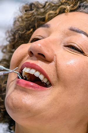 Saiba como a profilaxia dental evita 6 Problemas Bucais