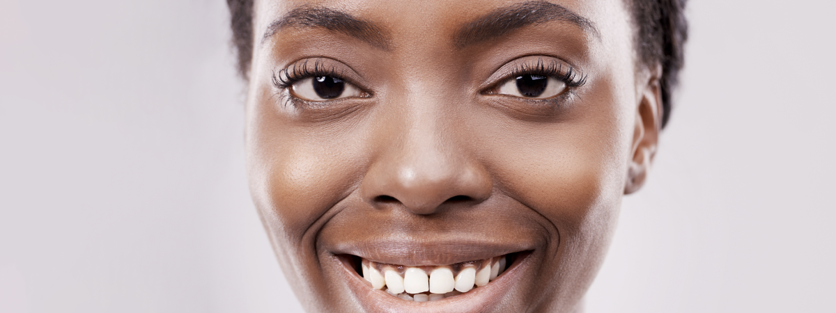Close-up de uma mulher negra sorrindo mostrando os dentes . Ela tem olhos castanhos e pele morena clara em fundo neutro.