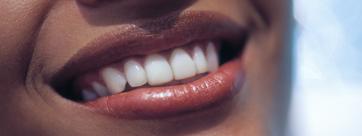 Mulher sorrindo com dentes brancos, lábios com batom cor de rosa claro e pele morena.