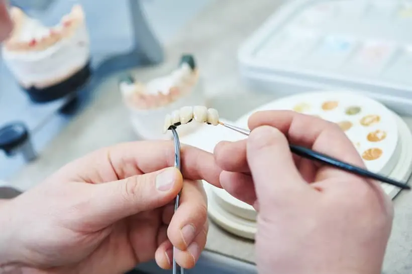 Próteses dentárias são feitas de material não orgânico e, por isso, não podem desenvolver cáries