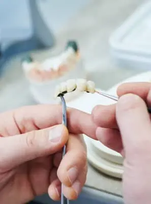 É possível ter cárie em próteses dentárias?