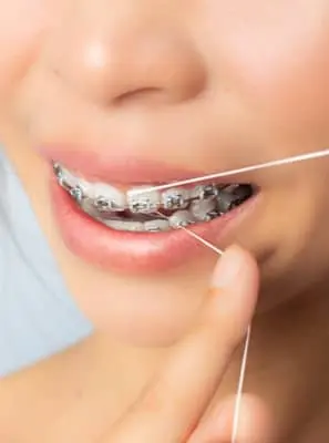 Fio dental Super Floss: como usar e quais suas vantagens