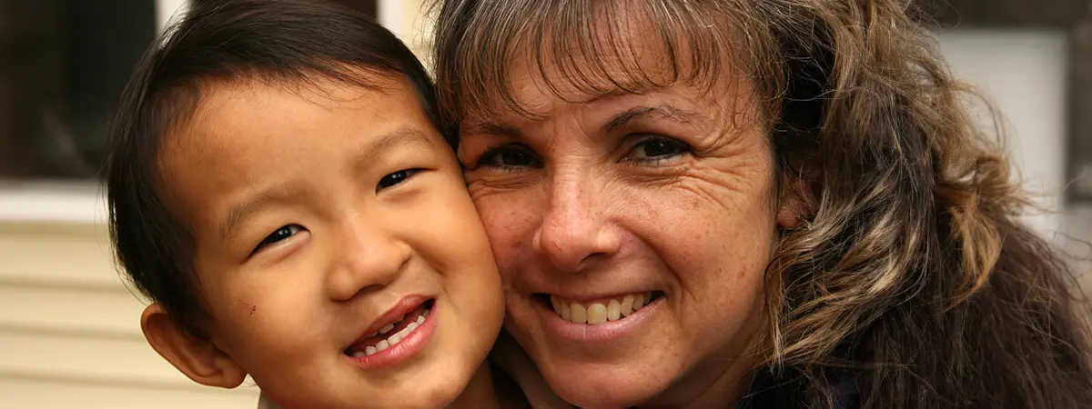 Menino asiático com lábio leporino sorrindo com mulher em selfie feliz