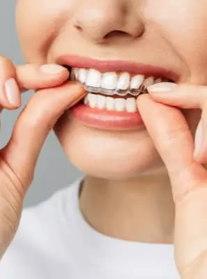 Clareamento nos dentes: deixar o produto mais tempo que o indicado clareia mais os dentes?