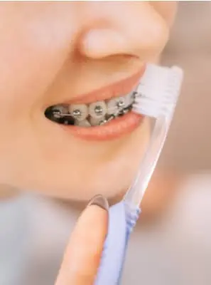 Tratamento ortodôntico causa sensibilidade nos dentes?