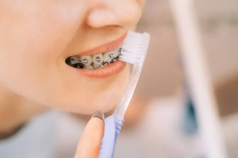 Durante o tratamento ortodôntico, é possível que o paciente sinta sensibilidade nos dentes, principalmente após algum ajuste (troca de fio ou aperto do aparelho)