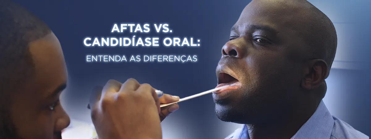 Homem recebendo exame oral com texto 'Aftas vs. Candidíase Oral: Entenda as Diferenças
