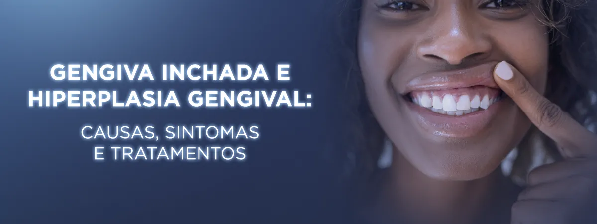 Imagem informativa sobre gengiva inchada e hiperplasia gengival, causas, sintomas e tratamentos, com uma mulher sorrindo e mostrando a gengiva.