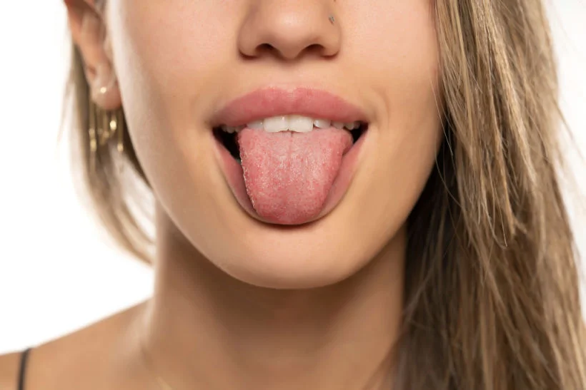lose-up de uma jovem mostrando a língua saudável e rosa, detalhes do rosto parcialmente visíveis com piercing no nariz.