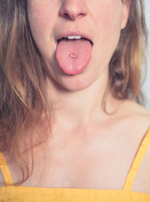 O piercing na boca inflamou: o que fazer?