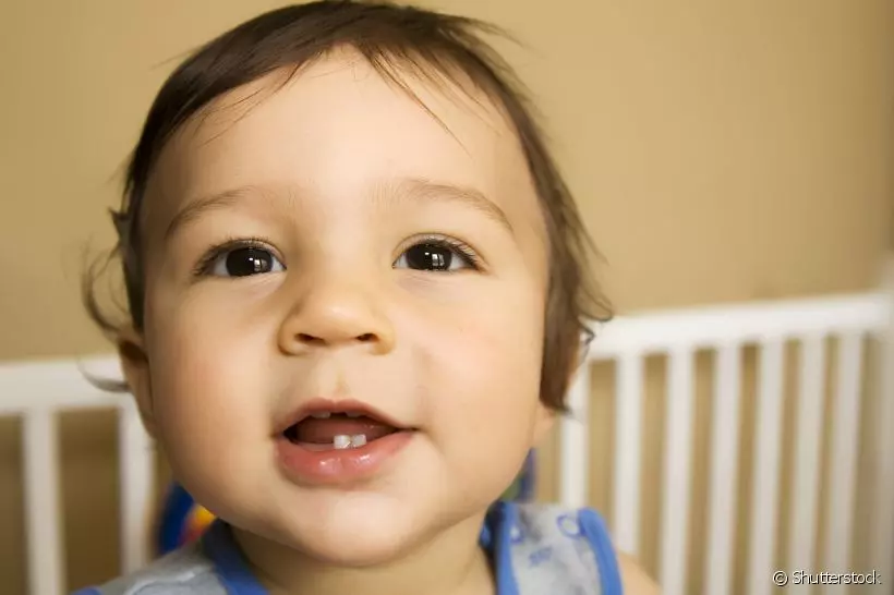 A cárie não aparece só no sorriso de adultos. Os bebês também sofrem com essa bactéria nos dentinhos de leite. Descubra como tratar e prevenir essa vilã