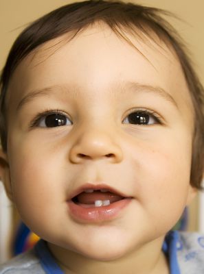 Odontopediatria: bebê pode ter cáries? Especialista esclarece
