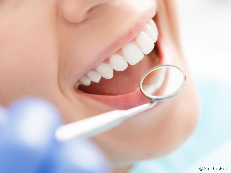 Em seguida, o profissional vai realizar um exame visual para saber se seus dentes estão prontos para receber o produto clareador.