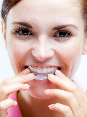 O que não deve ser feito no clareamento dental caseiro