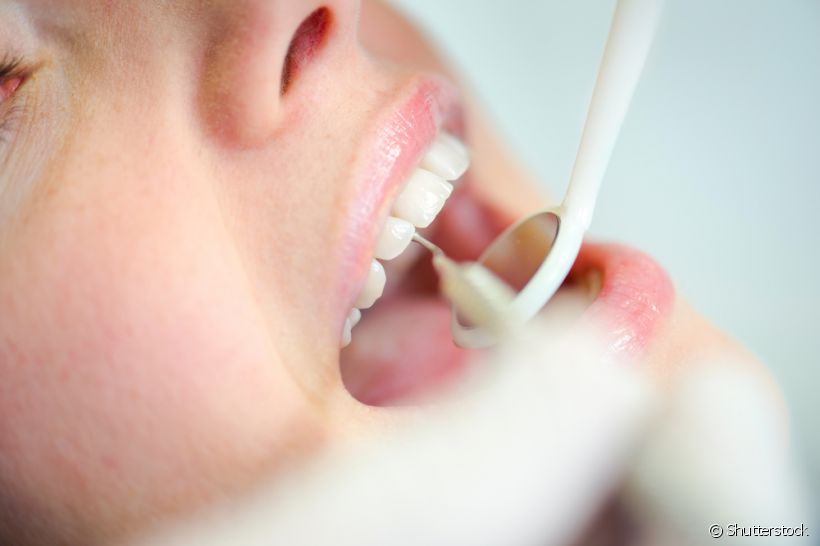 Se você acha que os cuidados com a saúde bucal podem diminuir depois de colocar um implante dentário, os especialistas garantem: prevenção nunca é demais