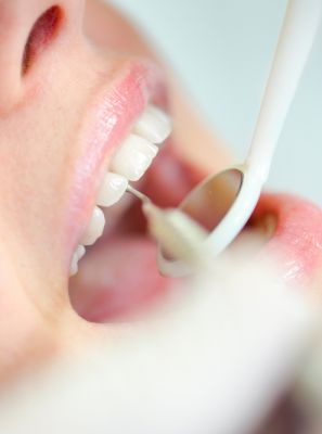 Quem usa implante pode ter periodontite, gengivite e cárie?