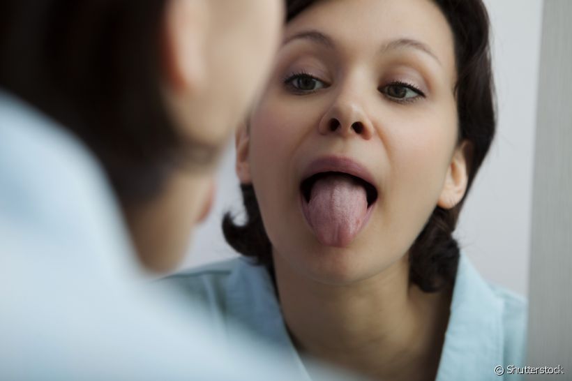 Para voltar a ter uma língua rosada e uma boca ainda mais saudável não tem segredo. O Sorrisologia descomplica o problema para você