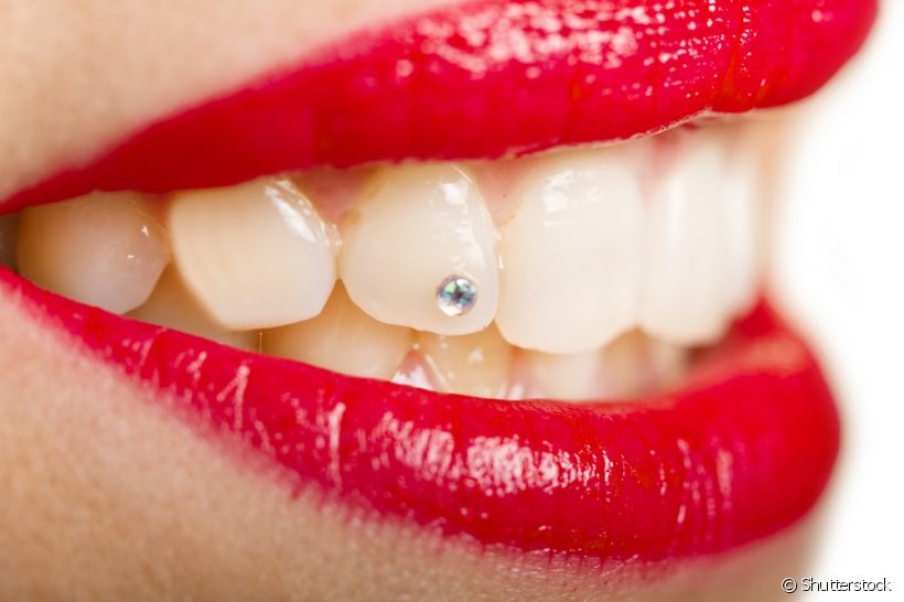 Já ouviu falar em piercing dental? Descubra tudo sobre este adereço na opinião de um especialista em Dentística