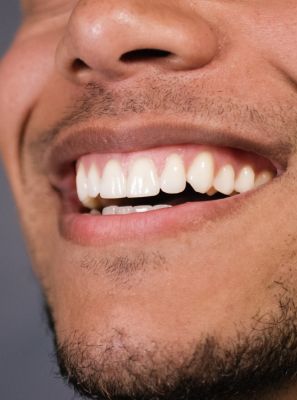 Benefícios da higiene bucal para a gengiva