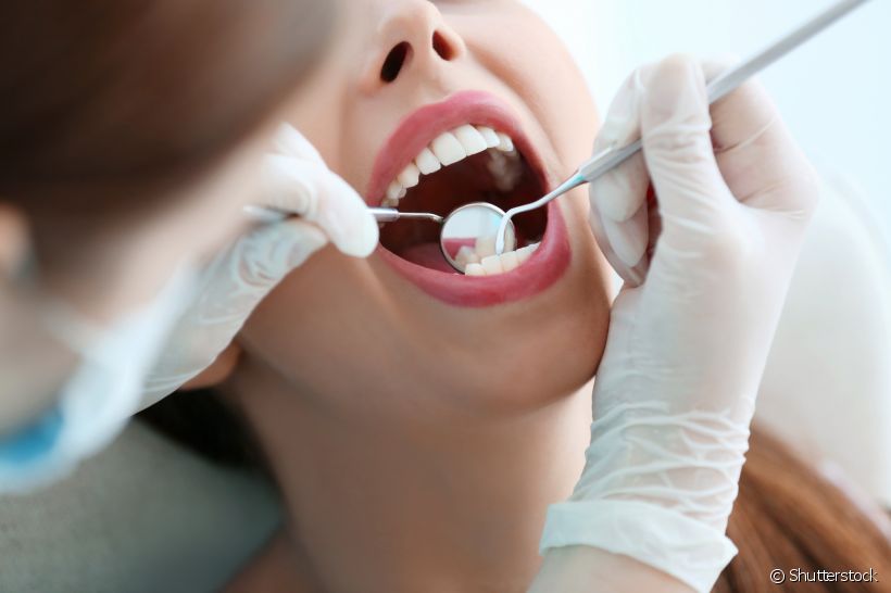 Nada de ignorar os primeiros sinais: saiba quais são os principais cuidados com a erosão dentária nas palavras da especialista