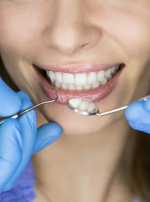 O que o especialista em Dentística pode fazer pelo meu sorriso?
