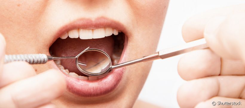 O tártaro já é um problema para os dentes naturais. Em prótese dentária a situação não é muito diferente. O periodontista Leonardo Costa conta como dar um fim no problema e, principalmente, como se prevenir dele