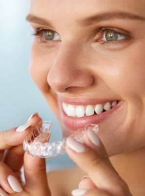 Clareamento caseiro: dentista cita prós e contras