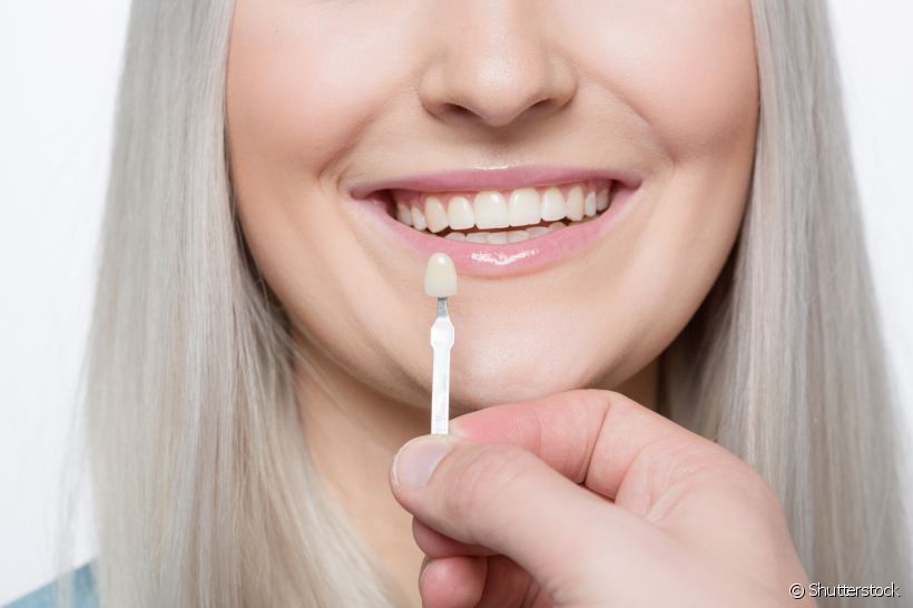 As lentes de contato dental são famosas por esconder alguns defeitos na estrutura do dente. Embora muitas pessoas estejam adotando a técnica, será que todos podem usá-las? Vinícius Barçal responde ao Sorrisologia