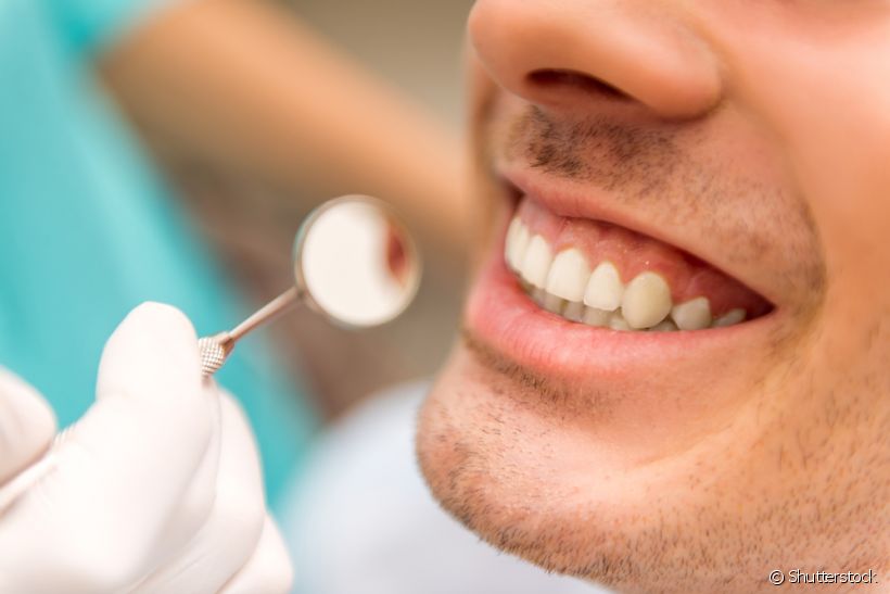 Além de dores e incômodos na face, a DTM pode causar um deslocamento nos dentes. Entenda por que isso acontece