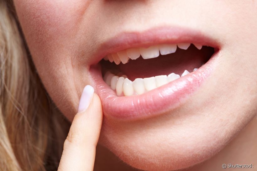 Está achando seus dentes mais longos? Ou um pouco mais separados? O especialista tira dúvidas sobre a relação de retração gengival com diastemas
