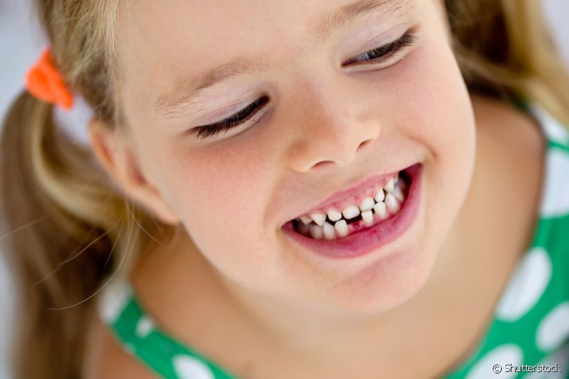 Preocupado com os dentes permanentes de seu filho que não nascem? A especialista explica melhor sobre o assunto e quando deve procurar um profissional