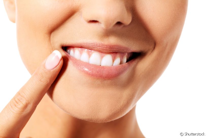 Os dentes de serrinha podem continuar até a vida adulta. Para casos em que esse cenário incomoda esteticamente, é possível corrigi-los com a ajuda de seu dentista
