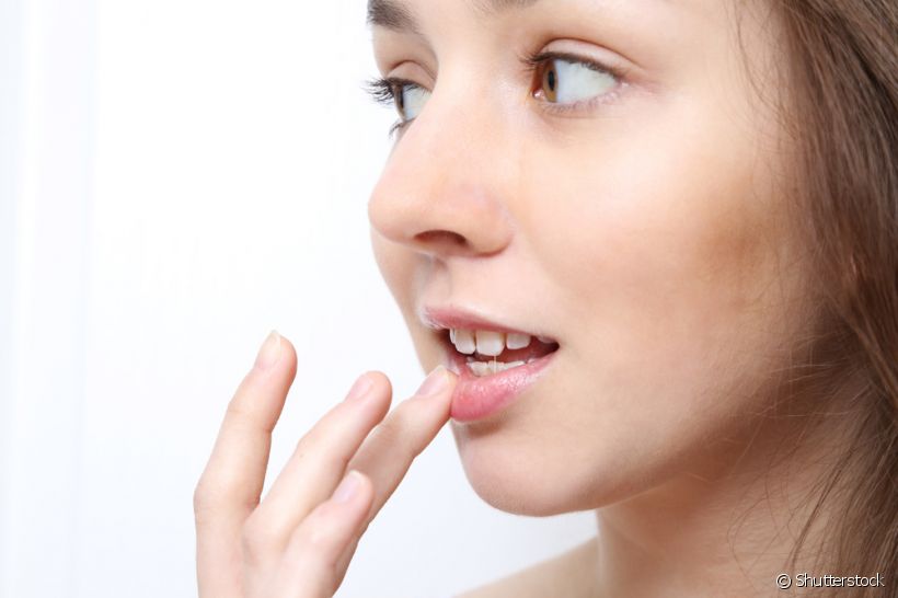 Saiba a diferença entre herpes bucal e afta. Especialista tira dúvidas sobre esse assunto! 