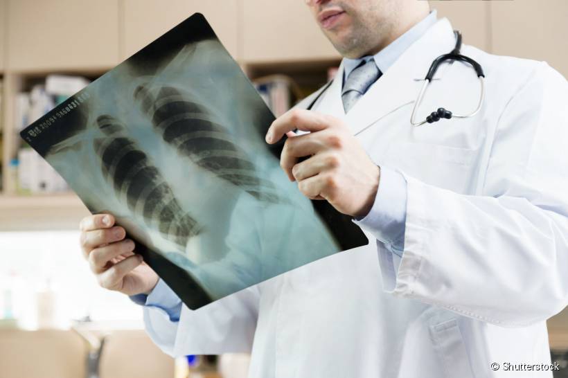 Também chamado de Raio-x, a radiografia é o mais tradicional e conhecido dos métodos de se obter imagem do interior do corpo