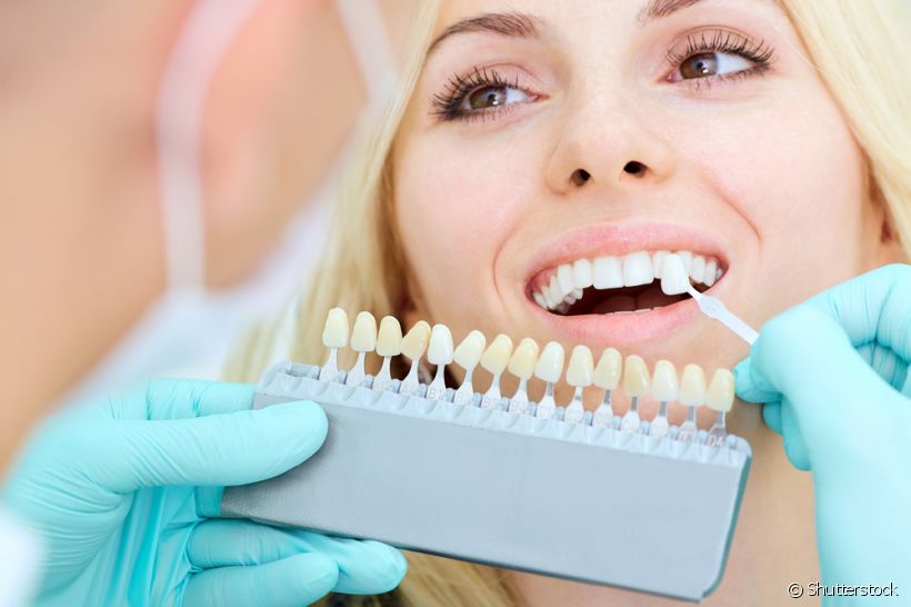 Está enganado quem pensa que as lentes de contato dental melhoram apenas a estética do sorriso! Conheça outras vantagens dessa técnica