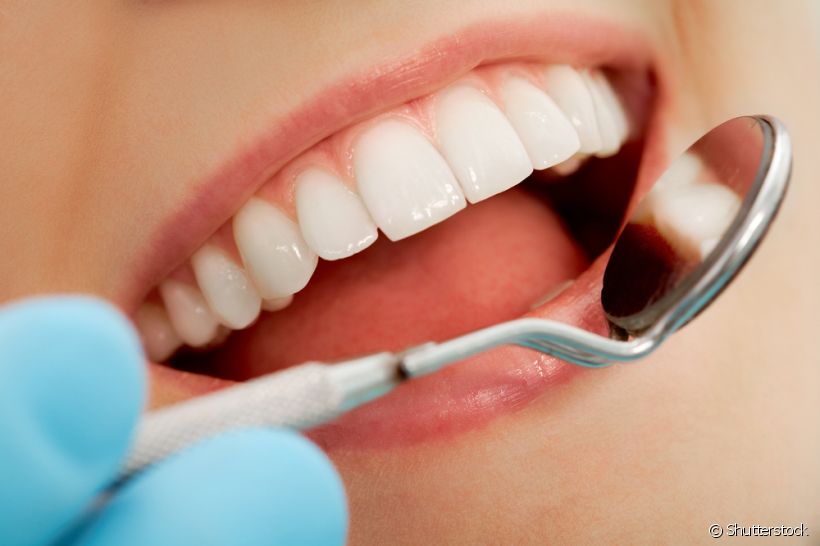 Restauração e obturação são procedimentos que recuperam dentes danificados. Entenda melhor cada um deles com a explicação de um especialista