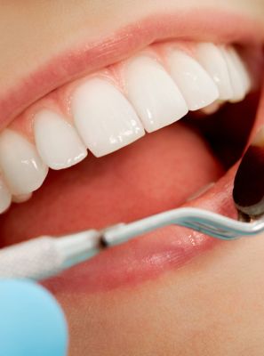 Restauração e obturação dentária: entenda a diferença
