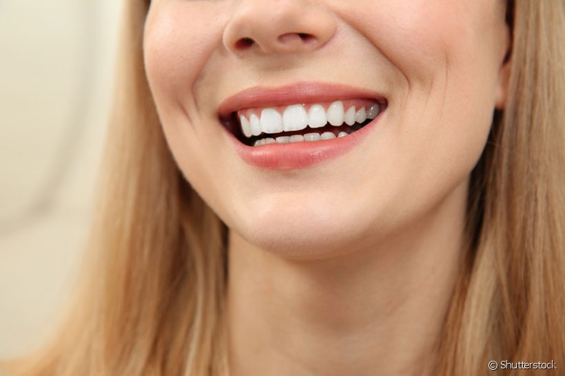 Quando o paciente vai fazer um clareamento dental, o primeiro pensamento é que irá sair do consultório com o sorriso super branco. Mas, e quando os resultados não correspondem às expectativas?
