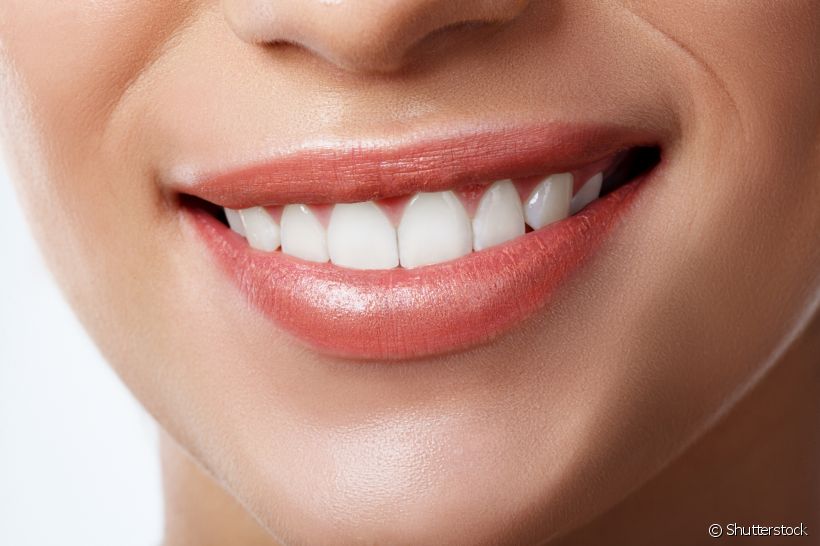 O clareamento dental consegue deixar seus dentes mais brancos. Mas, é preciso seguir os cuidados para sua manutenção. Entenda mais sobre o assunto com as explicações do profissional