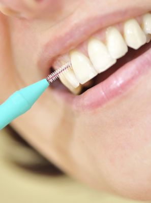 A escova interdental substitui o uso do fio dental?