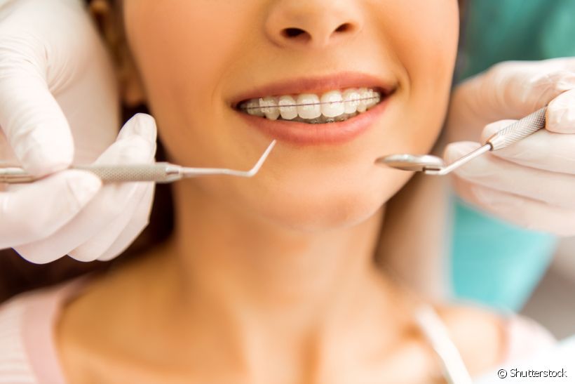 Os problemas que o dentista resolveu no primeiro tratamento ortodôntico voltaram? Confira se você precisa fazê-lo novamente