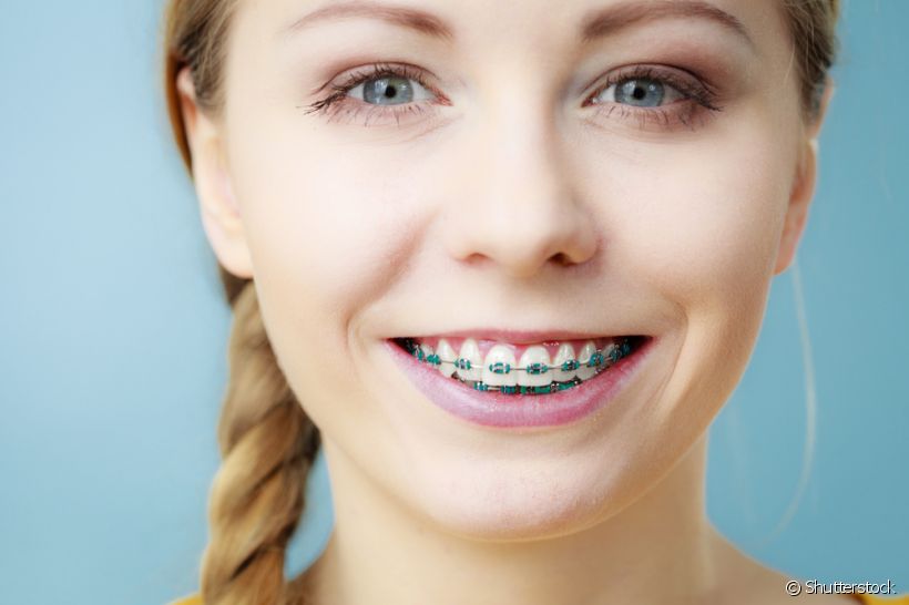 Sensibilidade dentária pode atrapalhar ou inviabilizar o tratamento ortodôntico? Veja o que a especialista explica sobre o assunto