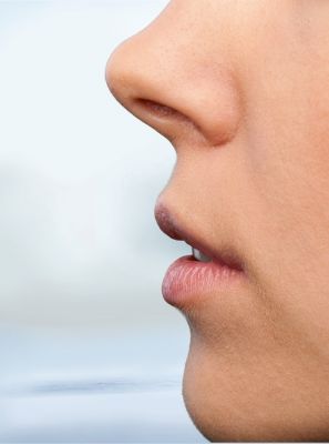 Respiração pela boca pode causar problemas bucais e de mastigação