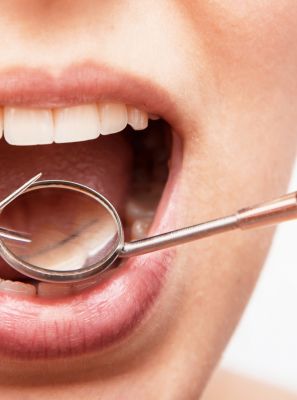 Infiltração na restauração dentária? O que é e prevenção