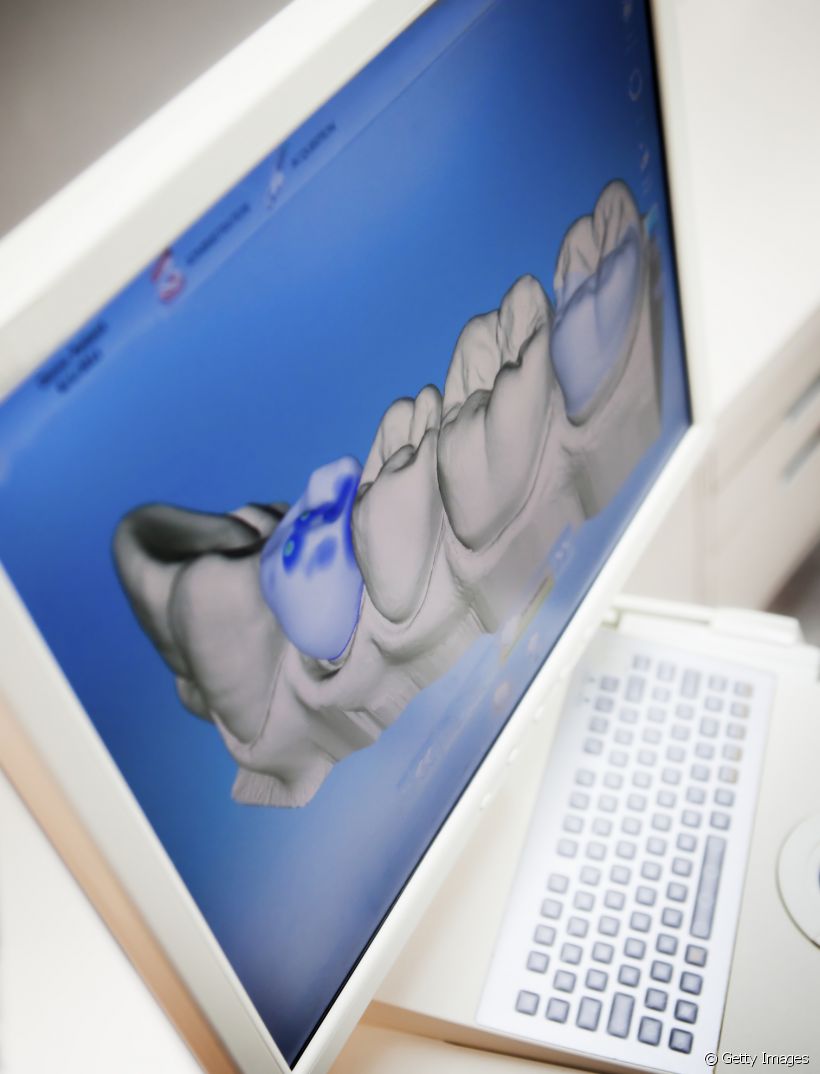 Você sabe o que significa Odontologia 3D? Saiba para que essa técnica serve e se beneficie de um sorriso ainda mais bonito
