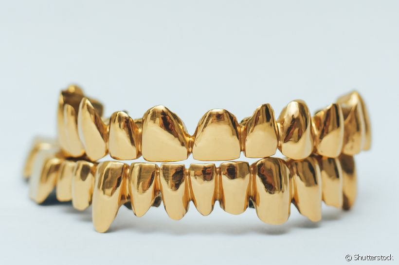 Os dentes de ouro e diamante podem comprometer a sua saúde bucal: entenda porquê!
